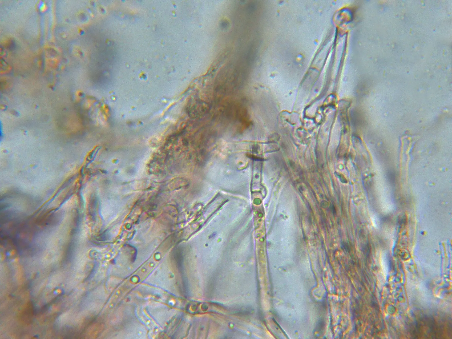 Microscopía de Stereophlebia tuberculata - 10 - Hifas subiculares-002
